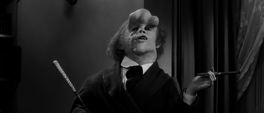 John Hurt dans Elephant Man